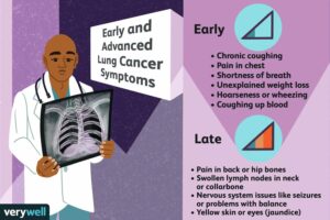 Symptoms to Walking Pneumonia